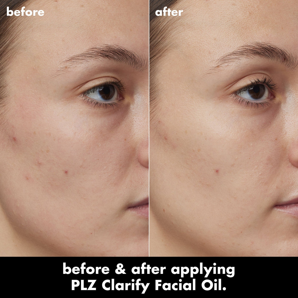 PLZ Clarify Facial Oil