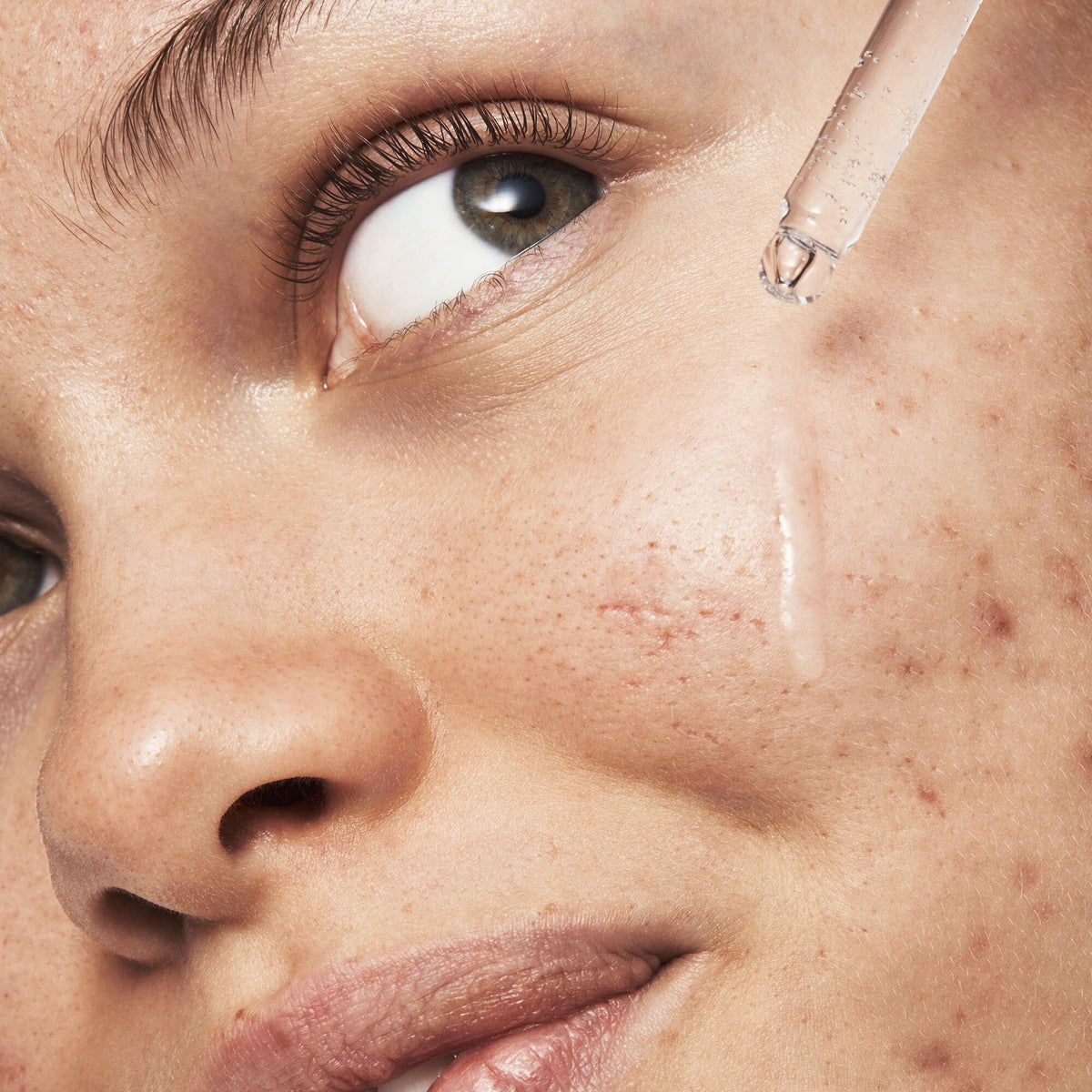 Blemish Breakthrough Triple-acid Resurfacing Serum
